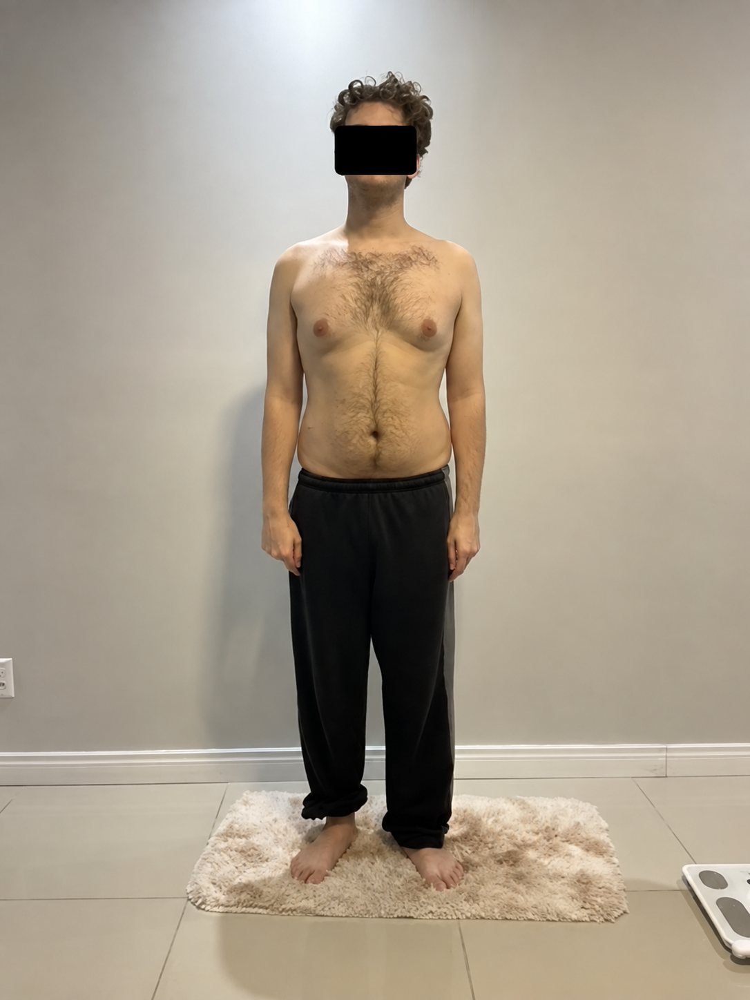 Resultado de acompanhamento corporal com identidade anonimizada